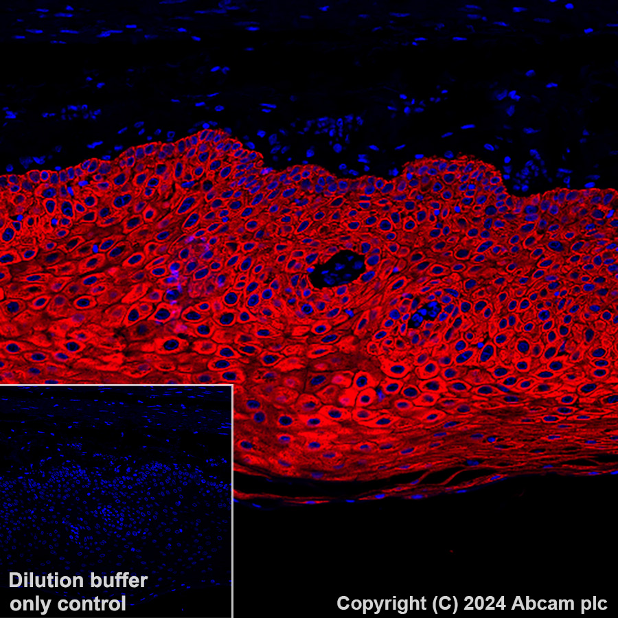 Alexa Fluor® 647 conjugated Anti-Cytokeratin antibody [EP1601Y