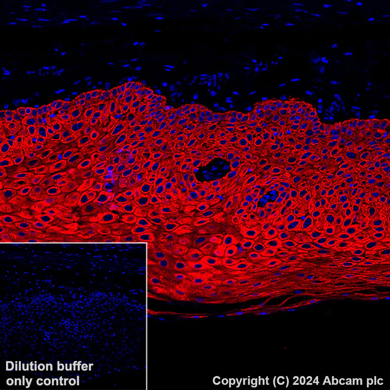 Immunohistochemistry (Formalin/PFA-fixed paraffin-embedded sections) - Alexa Fluor® 647 Anti-Cytokeratin 5 antibody [EP1601Y] (AB193895)