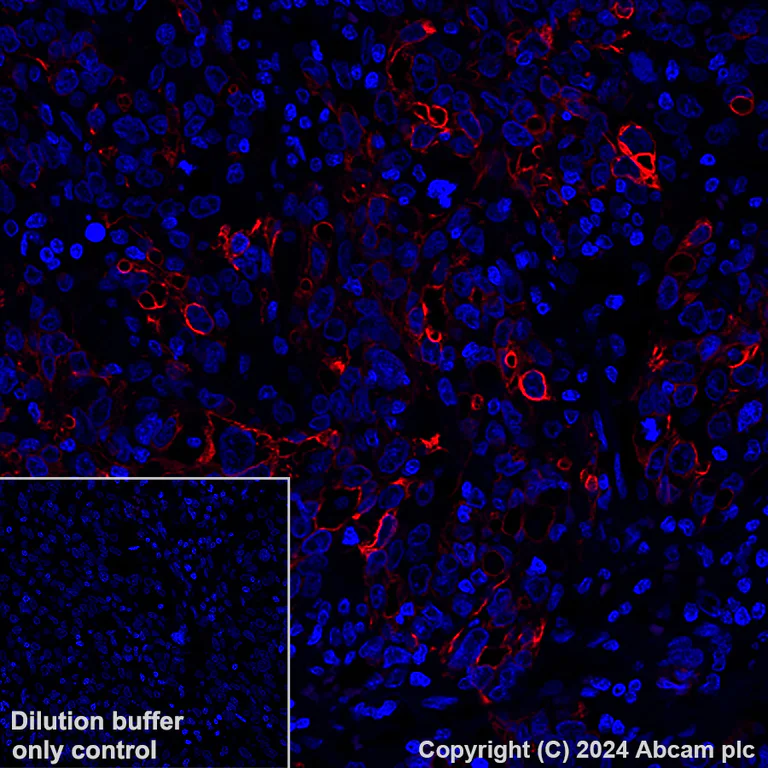 Alexa Fluor® 647 conjugated Anti-Cytokeratin 5 antibody [EP1601Y