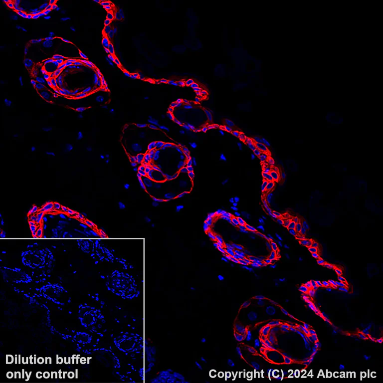 Immunohistochemistry (Formalin/PFA-fixed paraffin-embedded sections) - Alexa Fluor® 647 Anti-Cytokeratin 5 antibody [EP1601Y] (AB193895)