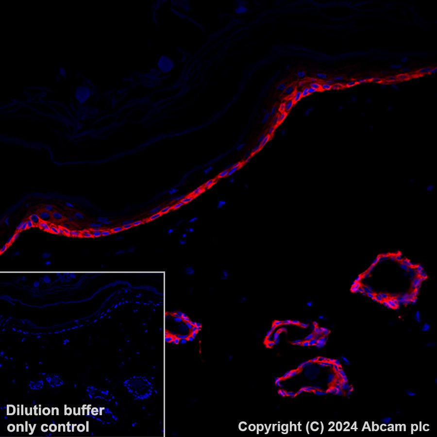 Alexa Fluor® 647 conjugated Anti-Cytokeratin 5 antibody [EP1601Y