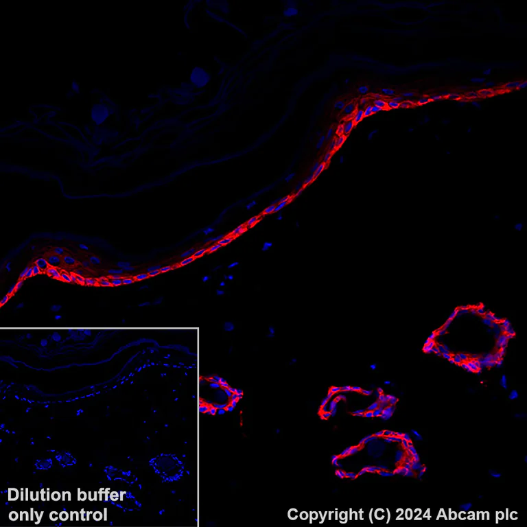 Immunohistochemistry (Formalin/PFA-fixed paraffin-embedded sections) - Alexa Fluor® 647 Anti-Cytokeratin 5 antibody [EP1601Y] (AB193895)