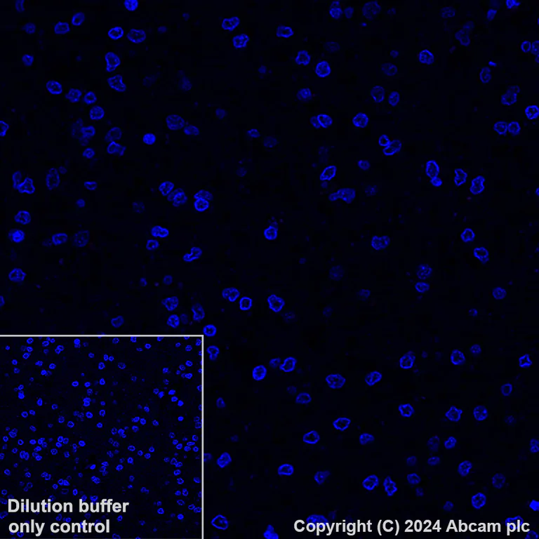 Alexa Fluor® 647 conjugated Anti-Cytokeratin 5 antibody [EP1601Y