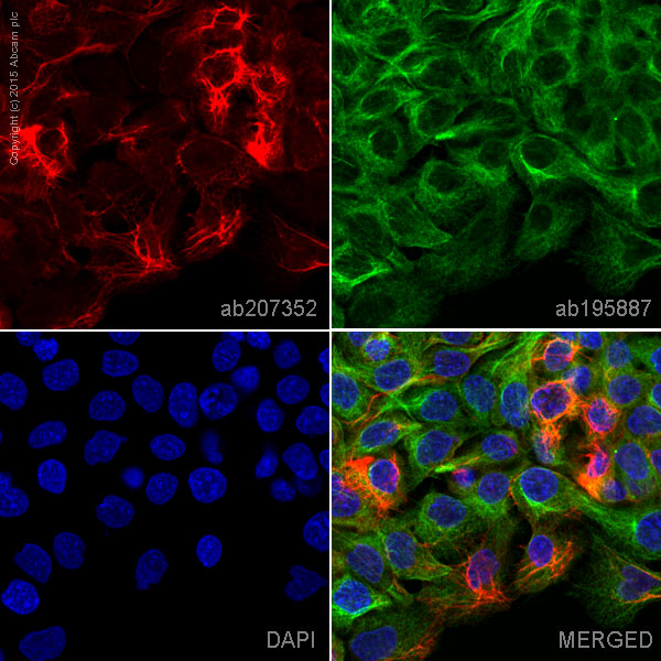 Immunocytochemistry/ Immunofluorescence - Alexa Fluor® 647 Anti-Cytokeratin 5 antibody [EPR1600Y] (AB207352)