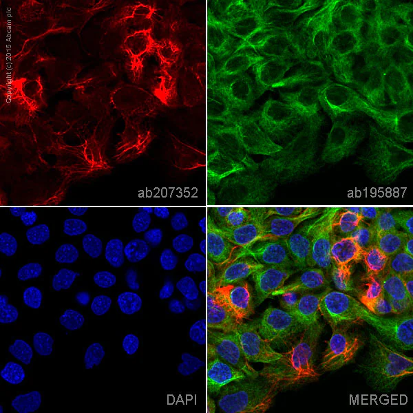 Immunocytochemistry/ Immunofluorescence - Alexa Fluor® 647 Anti-Cytokeratin 5 antibody [EPR1600Y] (AB207352)