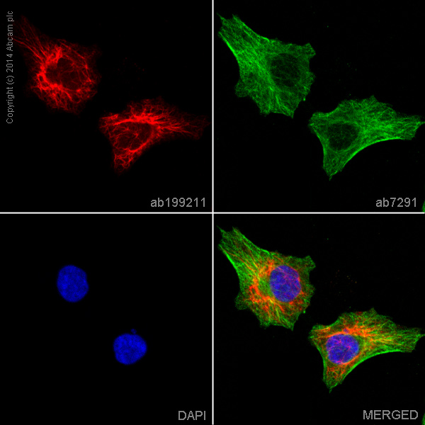 Immunocytochemistry/ Immunofluorescence - Alexa Fluor® 647 Anti-Cytokeratin 6 antibody [EPR1602Y] (AB199211)