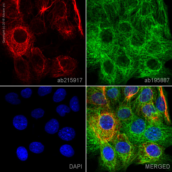 Immunocytochemistry/ Immunofluorescence - Alexa Fluor® 647 Anti-Cytokeratin 6 antibody [EPR1603Y] (AB215917)