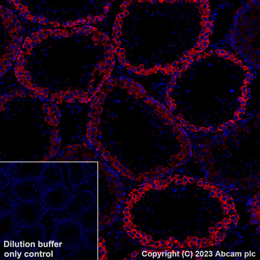Immunohistochemistry (Formalin/PFA-fixed paraffin-embedded sections) - Alexa Fluor® 647 Anti-DAZL antibody [EPR21028] (AB316874), expandable thumbnail