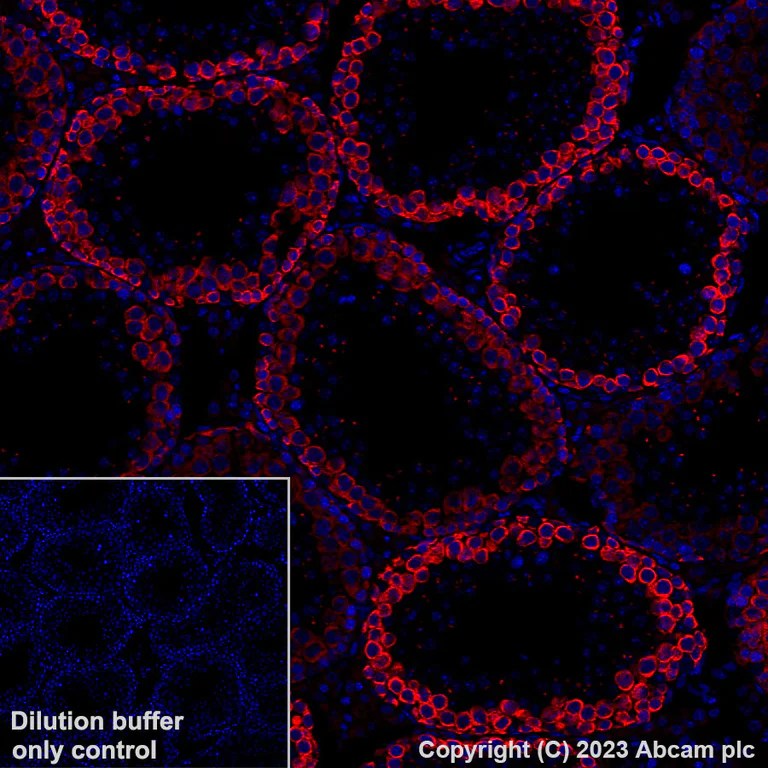 Immunohistochemistry (Formalin/PFA-fixed paraffin-embedded sections) - Alexa Fluor® 647 Anti-DAZL antibody [EPR21028] (AB316874)