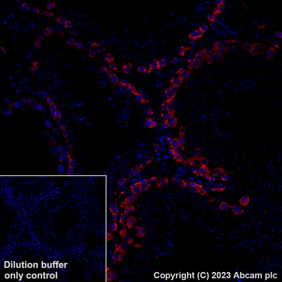 Immunohistochemistry (Formalin/PFA-fixed paraffin-embedded sections) - Alexa Fluor® 647 Anti-DAZL antibody [EPR21028] (AB316874), expandable thumbnail
