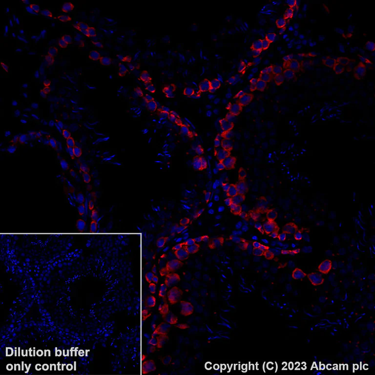 Immunohistochemistry (Formalin/PFA-fixed paraffin-embedded sections) - Alexa Fluor® 647 Anti-DAZL antibody [EPR21028] (AB316874)