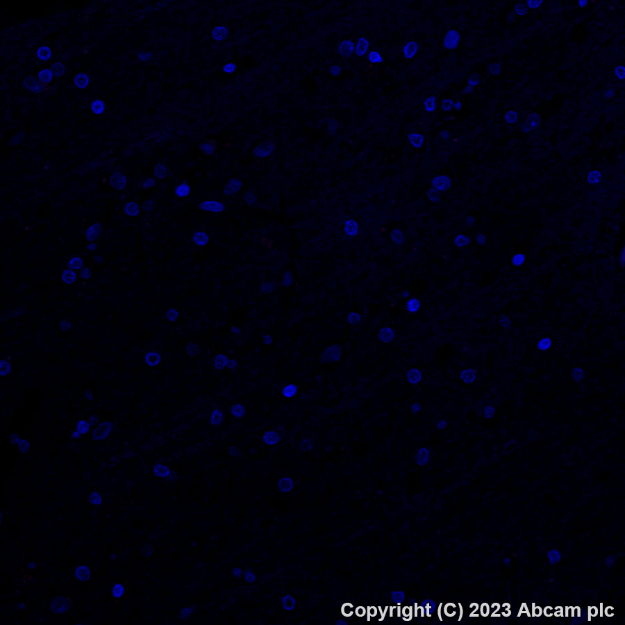 Immunohistochemistry (Formalin/PFA-fixed paraffin-embedded sections) - Alexa Fluor® 647 Anti-DAZL antibody [EPR21028] (AB316874), expandable thumbnail