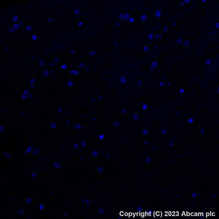 Immunohistochemistry (Formalin/PFA-fixed paraffin-embedded sections) - Alexa Fluor® 647 Anti-DAZL antibody [EPR21028] (AB316874)