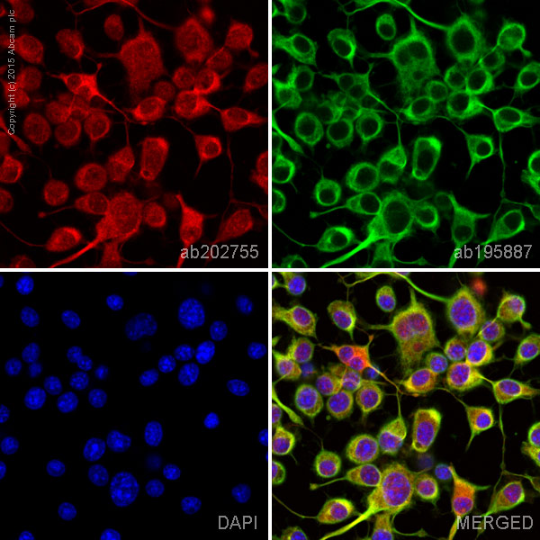 Immunocytochemistry/ Immunofluorescence - Alexa Fluor® 647 Anti-DCAMKL1 antibody [EPR6085] (AB202755)
