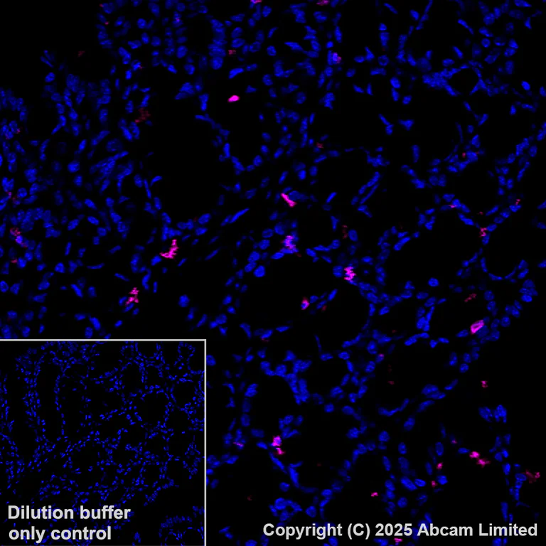 Immunohistochemistry (Formalin/PFA-fixed paraffin-embedded sections) - Alexa Fluor® 647 Anti-DCAMKL1 antibody [EPR6085] (AB202755)