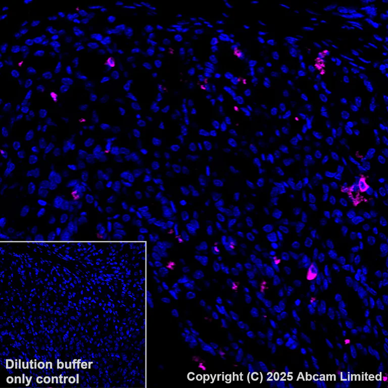 Immunohistochemistry (Formalin/PFA-fixed paraffin-embedded sections) - Alexa Fluor® 647 Anti-DCAMKL1 antibody [EPR6085] (AB202755)