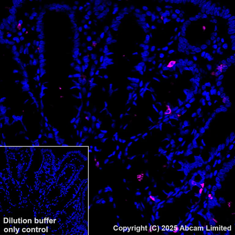 Immunohistochemistry (Formalin/PFA-fixed paraffin-embedded sections) - Alexa Fluor® 647 Anti-DCAMKL1 antibody [EPR6085] (AB202755)