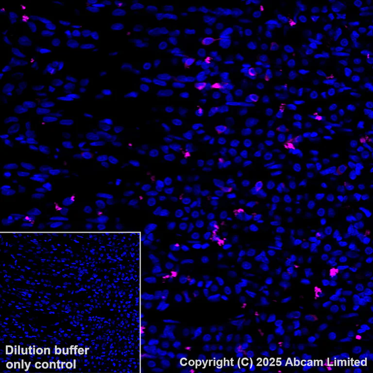Immunohistochemistry (Formalin/PFA-fixed paraffin-embedded sections) - Alexa Fluor® 647 Anti-DCAMKL1 antibody [EPR6085] (AB202755)