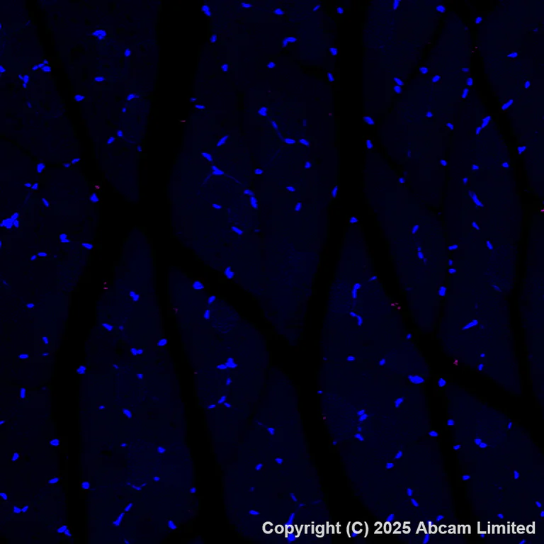 Immunohistochemistry (Formalin/PFA-fixed paraffin-embedded sections) - Alexa Fluor® 647 Anti-DCAMKL1 antibody [EPR6085] (AB202755)