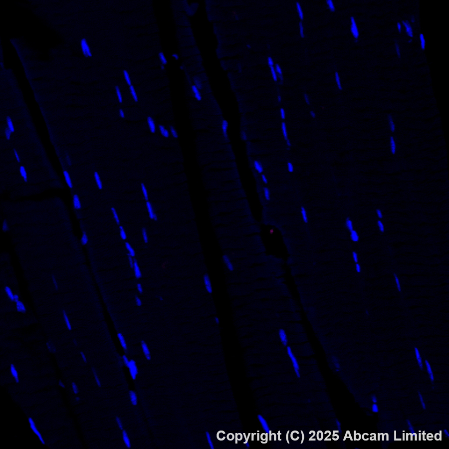 Immunohistochemistry (Formalin/PFA-fixed paraffin-embedded sections) - Alexa Fluor® 647 Anti-DCAMKL1 antibody [EPR6085] (AB202755)