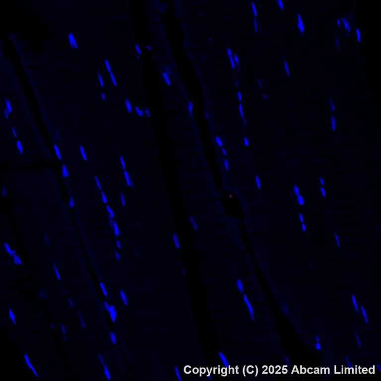 Immunohistochemistry (Formalin/PFA-fixed paraffin-embedded sections) - Alexa Fluor® 647 Anti-DCAMKL1 antibody [EPR6085] (AB202755)