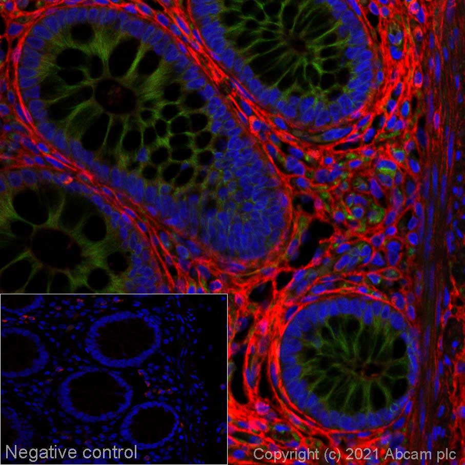Immunohistochemistry (Formalin/PFA-fixed paraffin-embedded sections) - Alexa Fluor® 647 Anti-Decorin antibody [EPR24097-105] (AB281326), expandable thumbnail