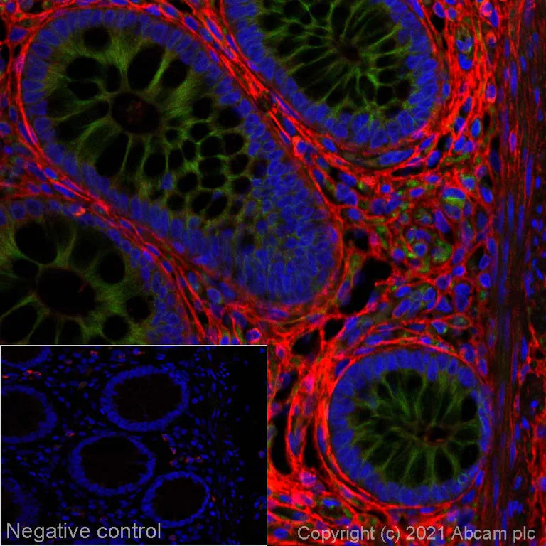 Immunohistochemistry (Formalin/PFA-fixed paraffin-embedded sections) - Alexa Fluor® 647 Anti-Decorin antibody [EPR24097-105] (AB281326)
