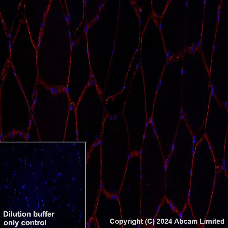 Immunohistochemistry (Formalin/PFA-fixed paraffin-embedded sections) - Alexa Fluor® 647 Anti-delta Sarcoglycan antibody [EPR8706] (AB319130)