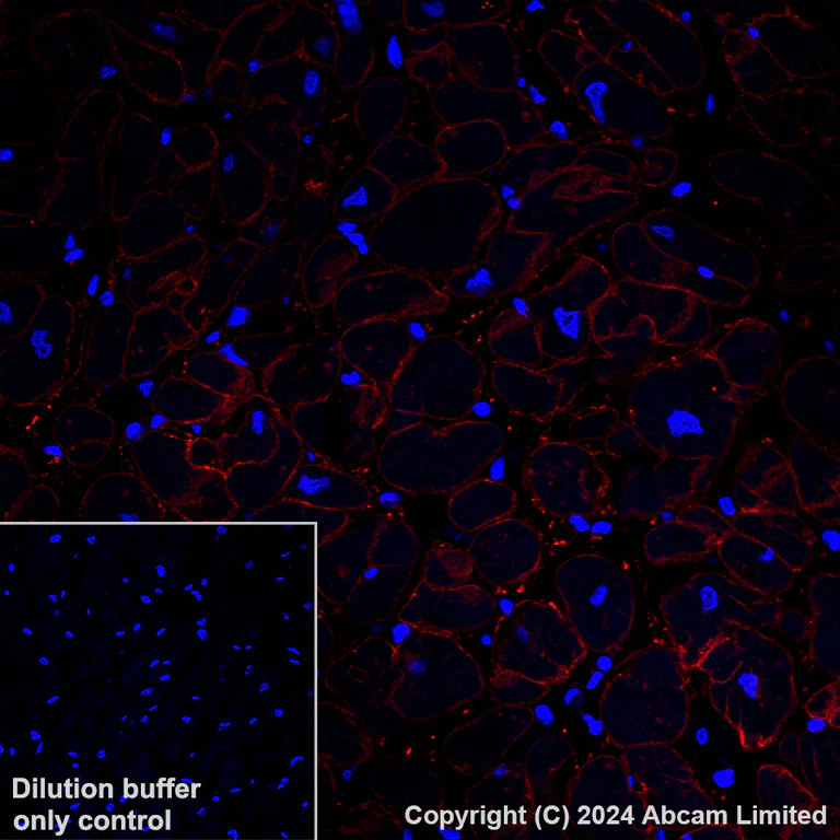 Immunohistochemistry (Formalin/PFA-fixed paraffin-embedded sections) - Alexa Fluor® 647 Anti-delta Sarcoglycan antibody [EPR8706] (AB319130)