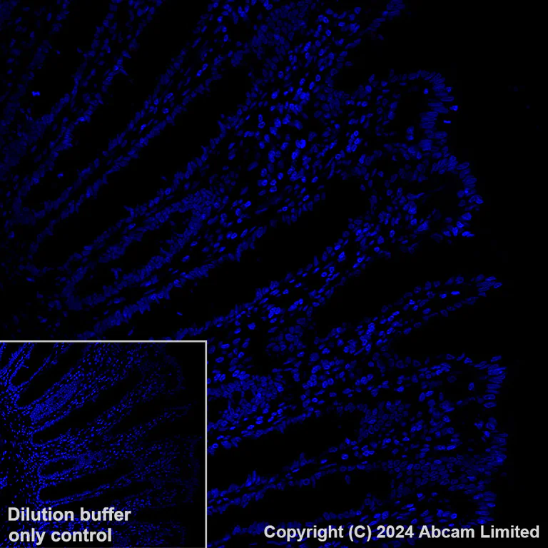 Immunohistochemistry (Formalin/PFA-fixed paraffin-embedded sections) - Alexa Fluor® 647 Anti-delta Sarcoglycan antibody [EPR8706] (AB319130)
