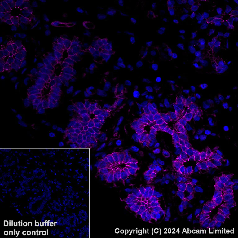 Immunohistochemistry (Formalin/PFA-fixed paraffin-embedded sections) - Alexa Fluor® 647 Anti-Desmoglein 2/DSG2 antibody [EPR6768] (AB322025)