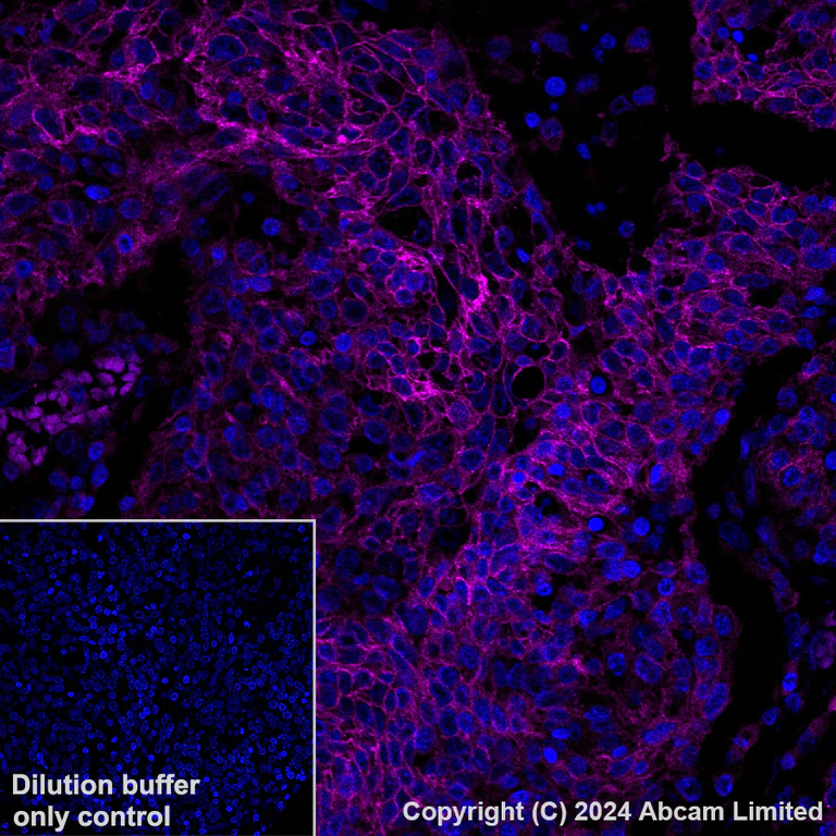 Immunohistochemistry (Formalin/PFA-fixed paraffin-embedded sections) - Alexa Fluor® 647 Anti-Desmoglein 2/DSG2 antibody [EPR6768] (AB322025)