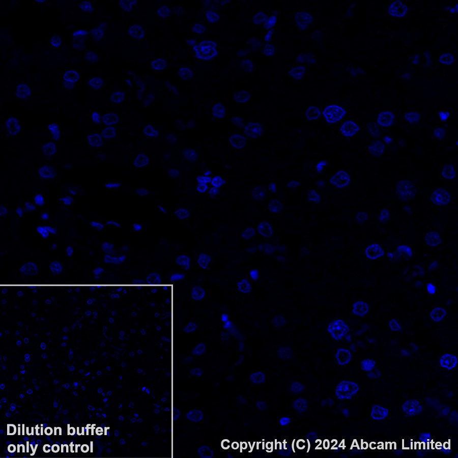 Immunohistochemistry (Formalin/PFA-fixed paraffin-embedded sections) - Alexa Fluor® 647 Anti-Desmoglein 2/DSG2 antibody [EPR6768] (AB322025), expandable thumbnail