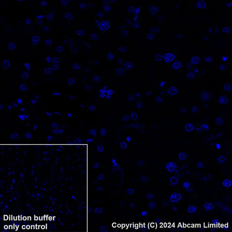 Immunohistochemistry (Formalin/PFA-fixed paraffin-embedded sections) - Alexa Fluor® 647 Anti-Desmoglein 2/DSG2 antibody [EPR6768] (AB322025)