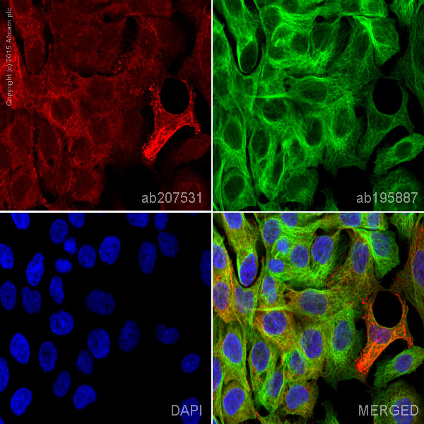 Immunocytochemistry/ Immunofluorescence - Alexa Fluor® 647 Anti-Desmoplakin antibody [EPR4383(2)] (AB207531), expandable thumbnail