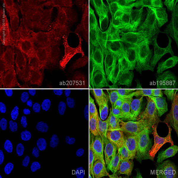 Immunocytochemistry/ Immunofluorescence - Alexa Fluor® 647 Anti-Desmoplakin antibody [EPR4383(2)] (AB207531)
