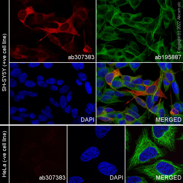 Immunocytochemistry/ Immunofluorescence - Alexa Fluor® 647 Anti-Doublecortin antibody [EPR19997] (AB307383)