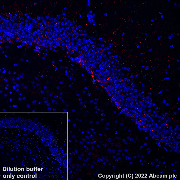Immunohistochemistry (Formalin/PFA-fixed paraffin-embedded sections) - Alexa Fluor® 647 Anti-Doublecortin antibody [EPR19997] (AB307383)