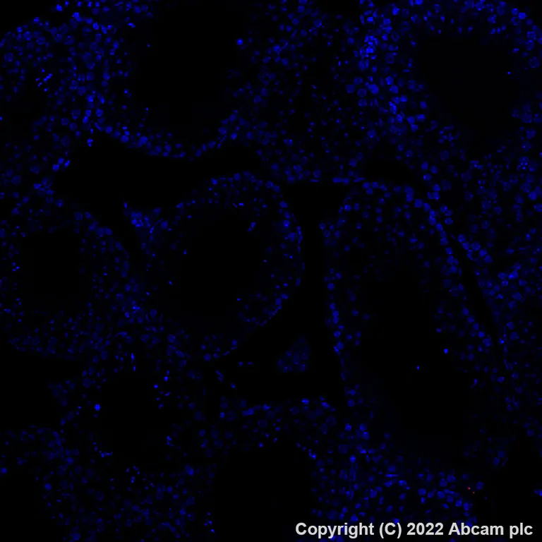 Immunohistochemistry (Formalin/PFA-fixed paraffin-embedded sections) - Alexa Fluor® 647 Anti-Doublecortin antibody [EPR19997] (AB307383)