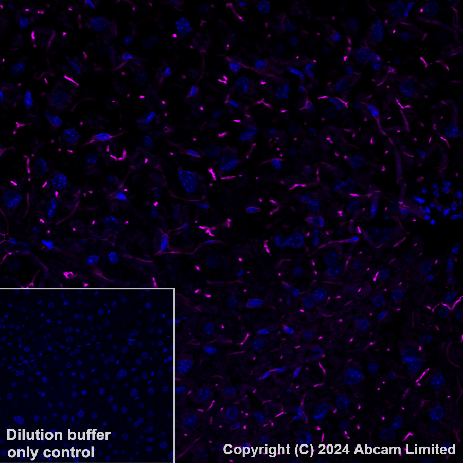 Immunohistochemistry (Formalin/PFA-fixed paraffin-embedded sections) - Alexa Fluor® 647 Anti-DPP4 antibody [EPR18215] (AB322420), expandable thumbnail