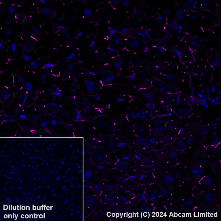Immunohistochemistry (Formalin/PFA-fixed paraffin-embedded sections) - Alexa Fluor® 647 Anti-DPP4 antibody [EPR18215] (AB322420)