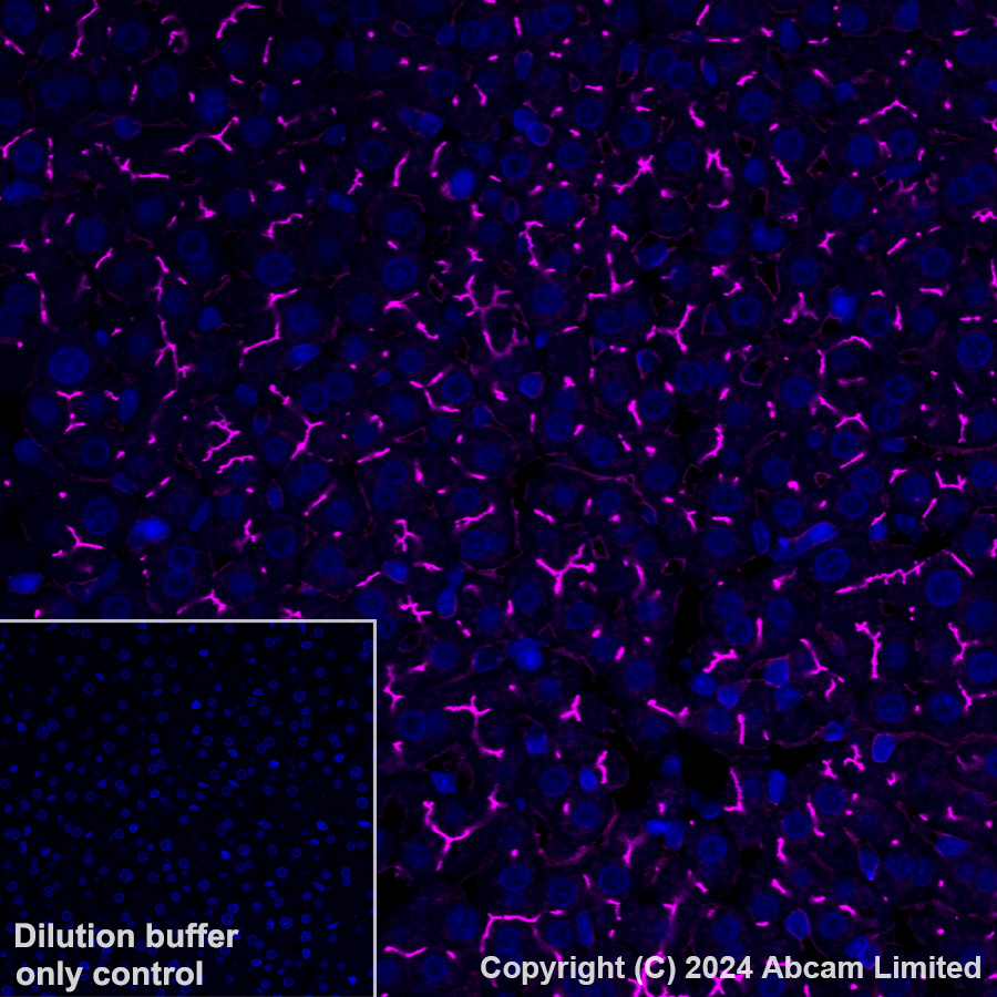 Immunohistochemistry (Formalin/PFA-fixed paraffin-embedded sections) - Alexa Fluor® 647 Anti-DPP4 antibody [EPR18215] (AB322420), expandable thumbnail