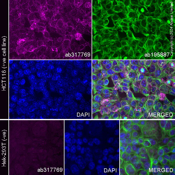 Immunohistochemistry (Formalin/PFA-fixed paraffin-embedded sections) - Alexa Fluor® 647 Anti-DR4 antibody [EPR28152-57] (AB317769)