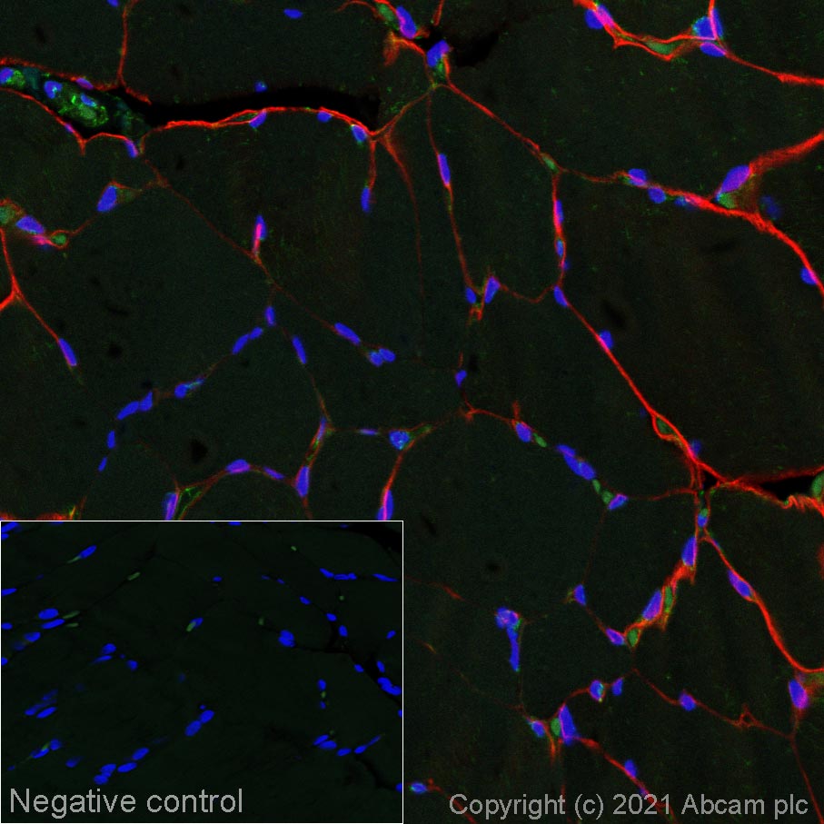 Immunohistochemistry (Formalin/PFA-fixed paraffin-embedded sections) - Alexa Fluor® 647 Anti-Dystrophin antibody [EPR23336-129] (AB282171)