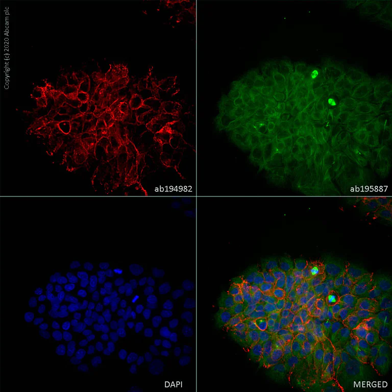 Immunocytochemistry/ Immunofluorescence - Alexa Fluor® 647 Anti-E Cadherin antibody [EP700Y] - Intercellular Junction Marker (AB194982)
