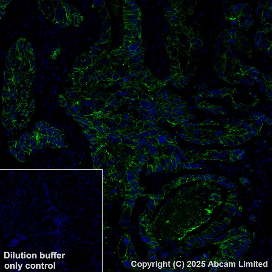 Immunohistochemistry (Formalin/PFA-fixed paraffin-embedded sections) - Alexa Fluor® 647 Anti-E Cadherin antibody [EP700Y] - Intercellular Junction Marker (AB194982)