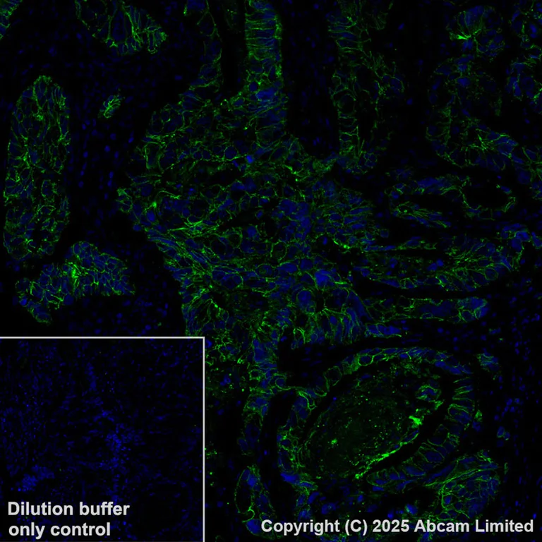 Immunohistochemistry (Formalin/PFA-fixed paraffin-embedded sections) - Alexa Fluor® 647 Anti-E Cadherin antibody [EP700Y] - Intercellular Junction Marker (AB194982)