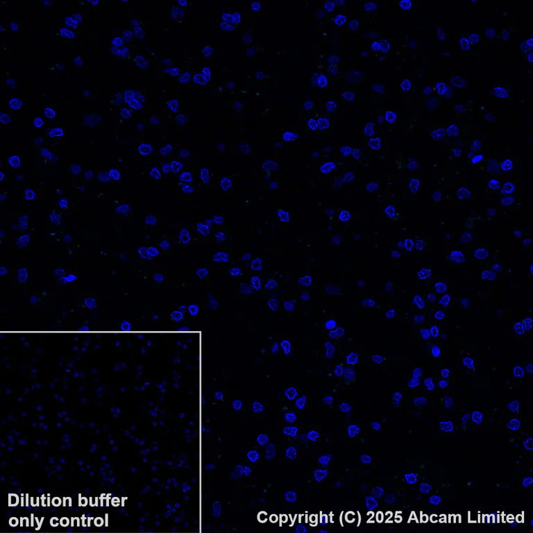 Immunohistochemistry (Formalin/PFA-fixed paraffin-embedded sections) - Alexa Fluor® 647 Anti-E Cadherin antibody [EP700Y] - Intercellular Junction Marker (AB194982)