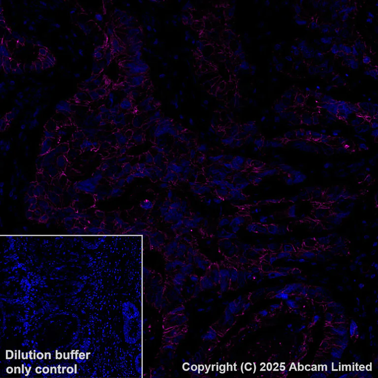 Immunohistochemistry (Formalin/PFA-fixed paraffin-embedded sections) - Alexa Fluor® 647 Anti-E Cadherin antibody [EP700Y] - Intercellular Junction Marker (AB194982)