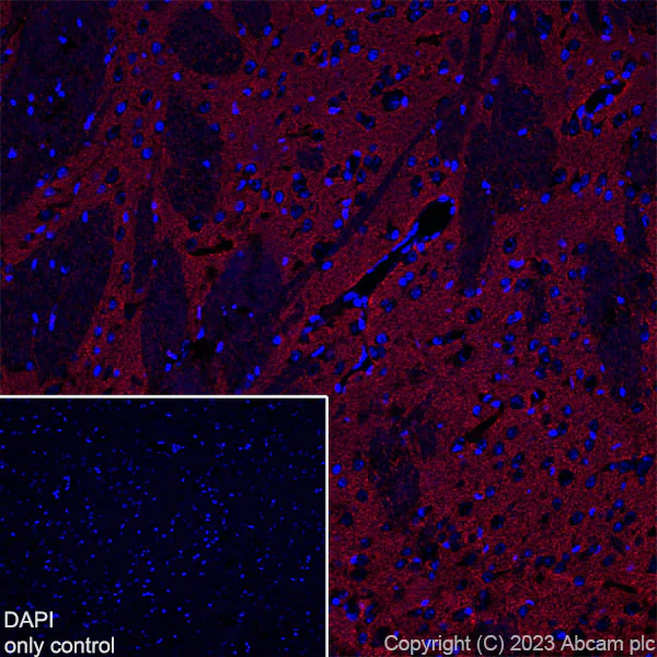 Immunohistochemistry (Frozen sections) - Alexa Fluor® 647 Anti-EAAT2 antibody [EPR19798] (AB313822)